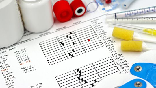 Jak korzystać z mobilnych usług pielęgniarskich w Warszawie — przewodnik dla pacjentów