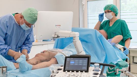 Leczenie żylaków u osób z zakrzepicą